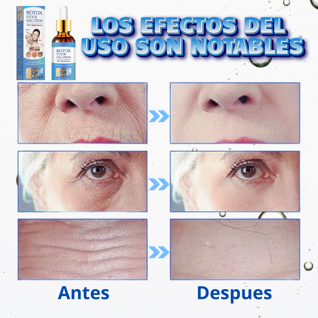 Botox Stock Solution Suero antiarrugas